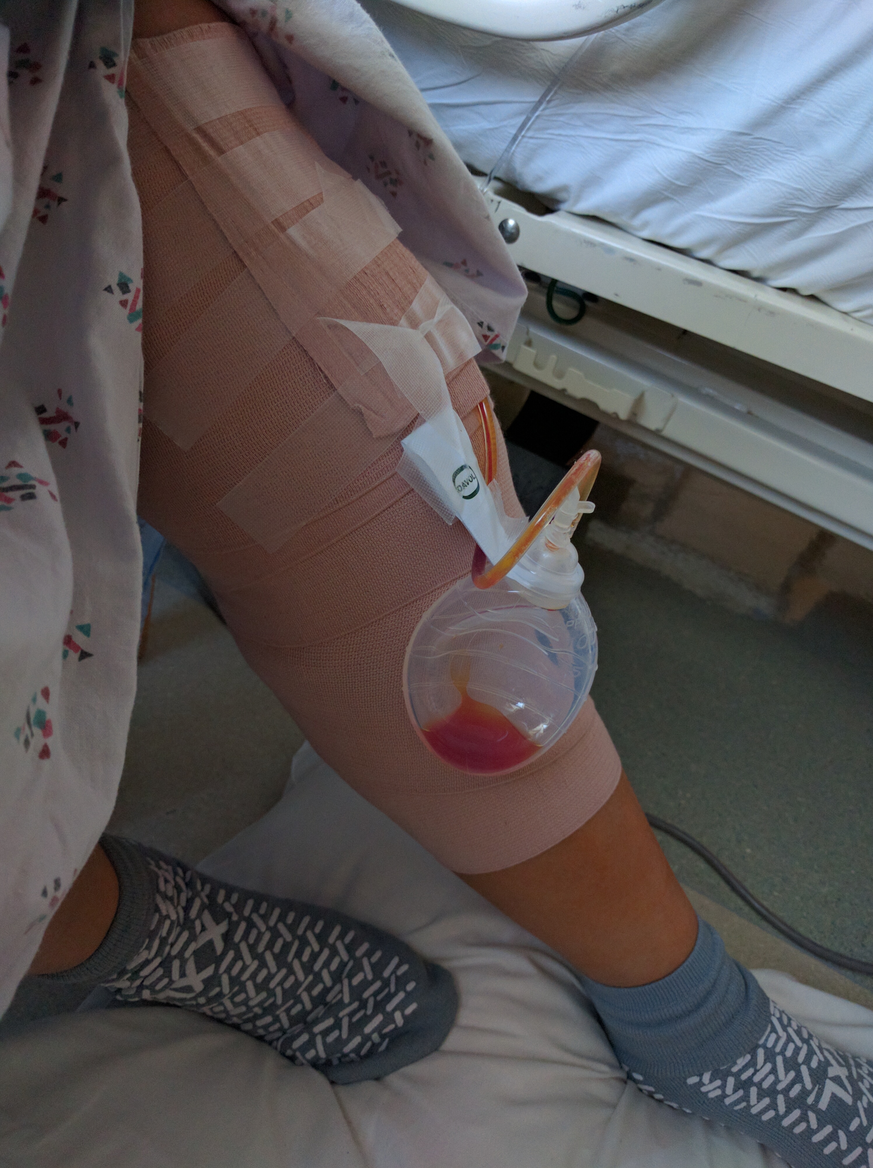 Hospital Stay Knee Drainage